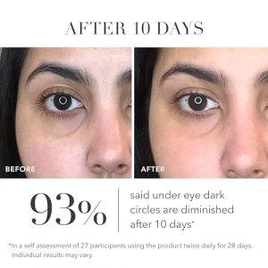 Alternative view of Algenist Triple Algae Eye Renewal Balm - Hydrating Vegan Eye Cream with Caffeine, Alguronic Acid & Peptides to Help Reduce Dark Circles, Puffiness, Fine Lines & Wrinkles - Travel Size (0.5 oz)